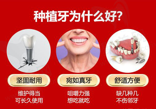 种植牙为什么好
