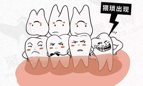 智齿疼不能拔怎么快速止疼