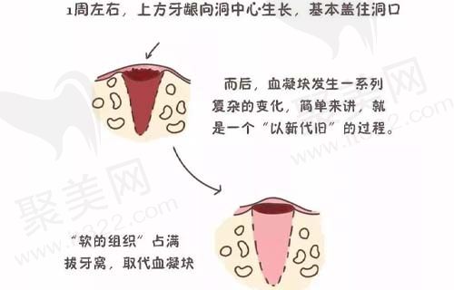 慢慢开始覆盖