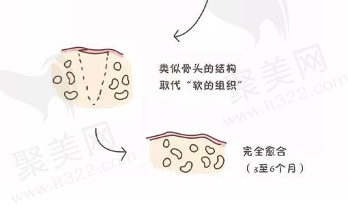 直到愈合