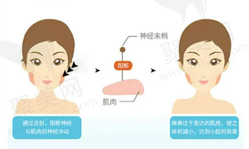 瘦脸