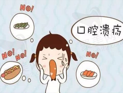 口腔溃疡