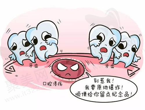 口腔溃疡