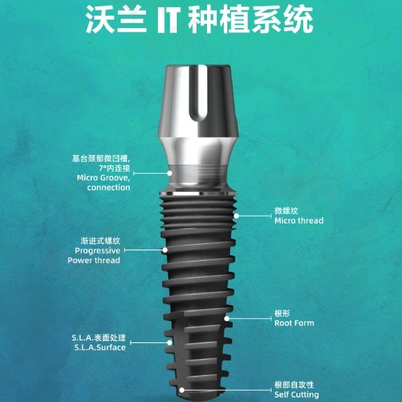 韩国沃兰种植体