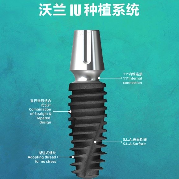 韩国沃兰种植体优势有哪些呢？