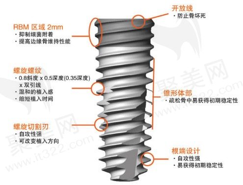 韩国奥齿泰种植体优势