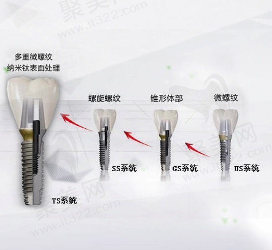 韩国种植体哪个品牌好