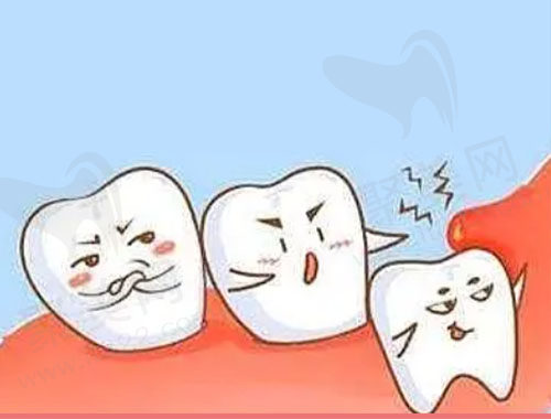 智齿牙龈发炎肿痛
