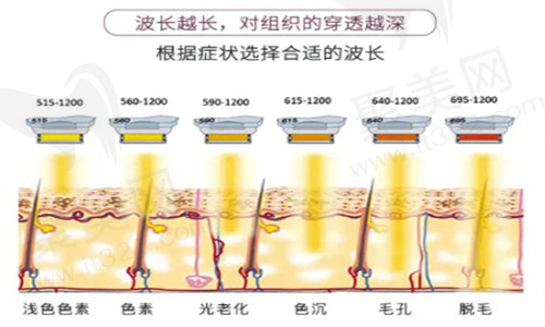 M22黄金超光子