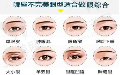 眼综合