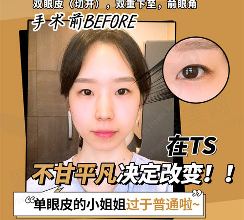 术前形象