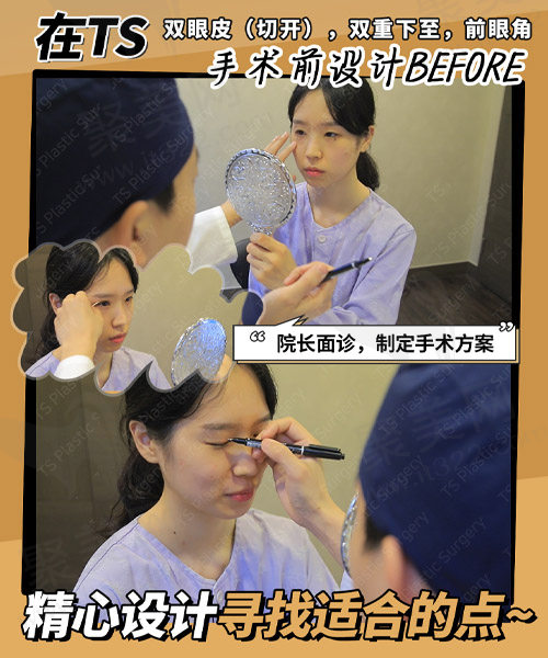 咨询医生