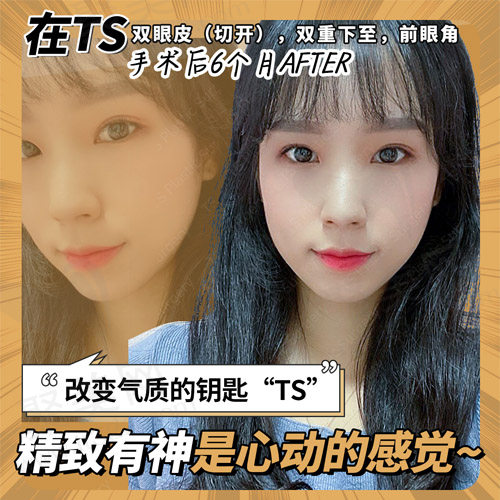 术后六个月变化