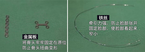 面部轮廓所需材质