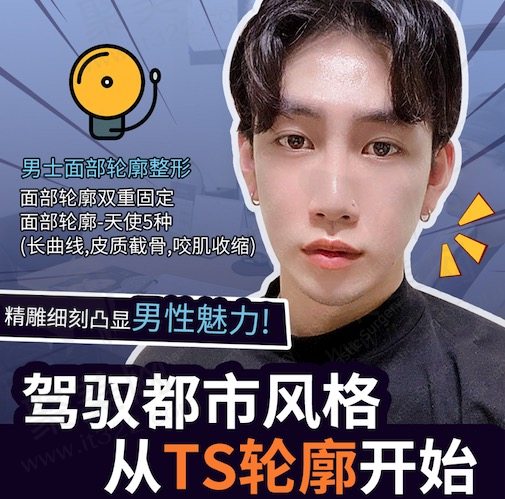 韩国TS李相均男士面部轮廓手术
