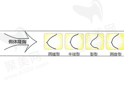 假体隆胸