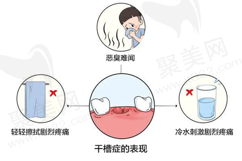 干槽症