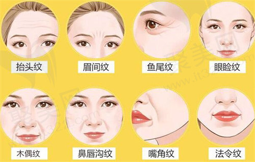热玛吉