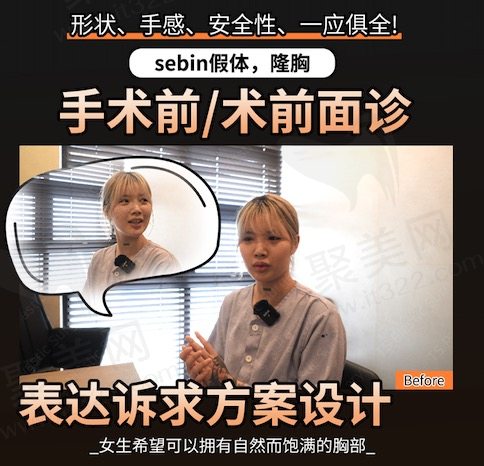 韩国TS整形外科医院假体隆胸手术面诊