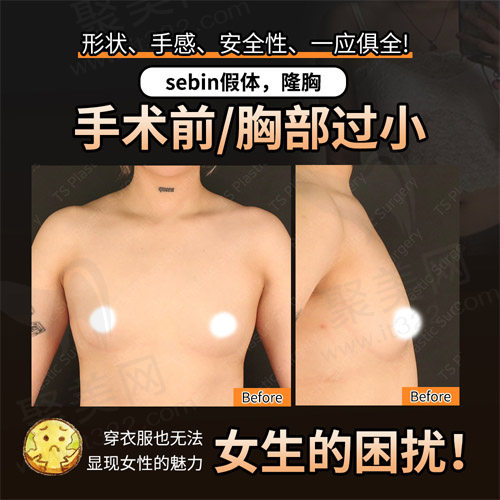 平胸前期困扰