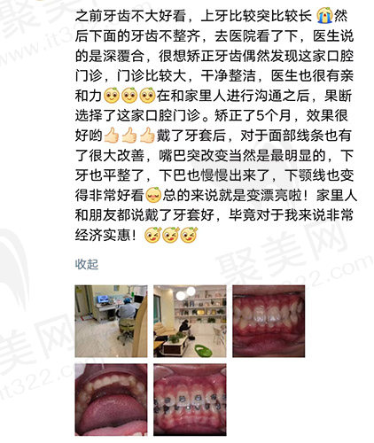 赣州爱牙仕口腔评价