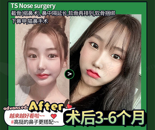 术后三至六个月