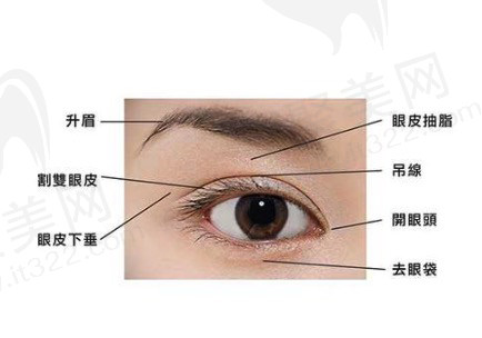 双眼皮整形