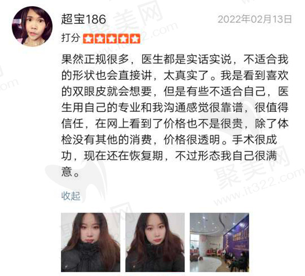 房红超双眼皮怎么样