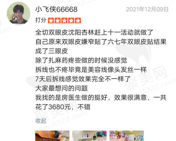 房红超双眼皮怎么样