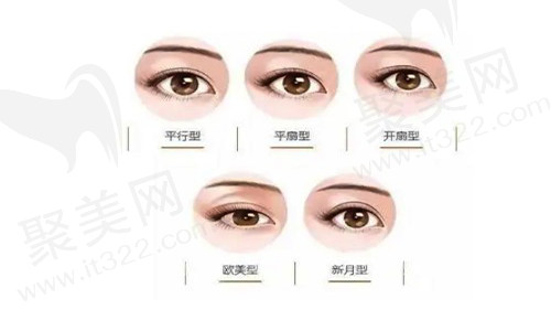 双眼皮整形