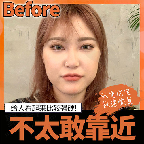 手术前形象