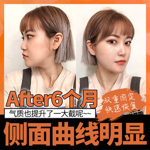 术后6个月的变化