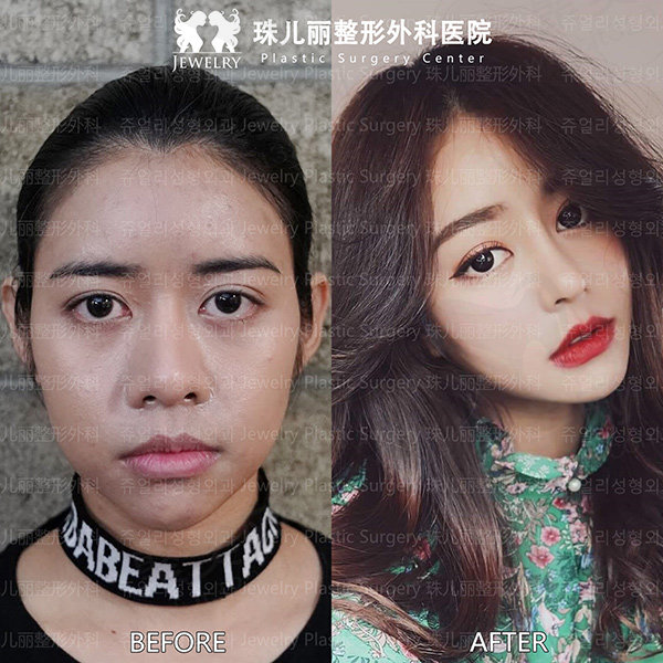 韩国珠儿丽医院口碑
