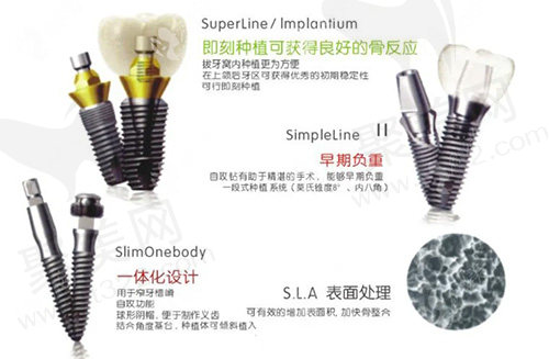 韩国登腾种植牙优势