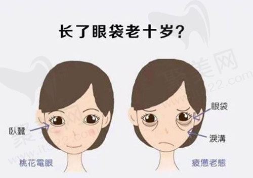 温州星范整形医院隐形祛眼袋