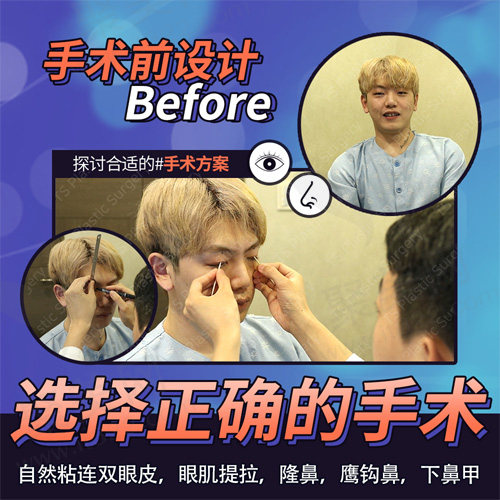 代表院长术前诊断