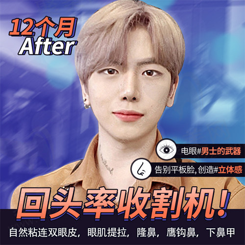 术后正面变化