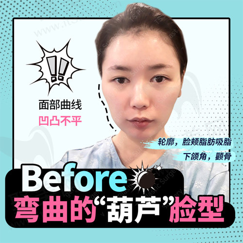 求美者整形前外貌