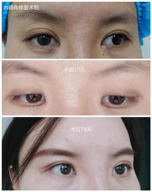 魏志香高难度眼睛修复技术好，患者口碑评价高