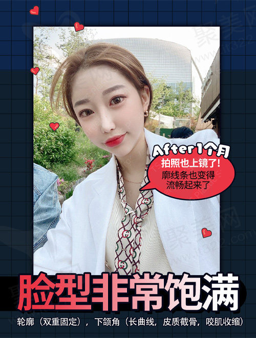 术后一个月