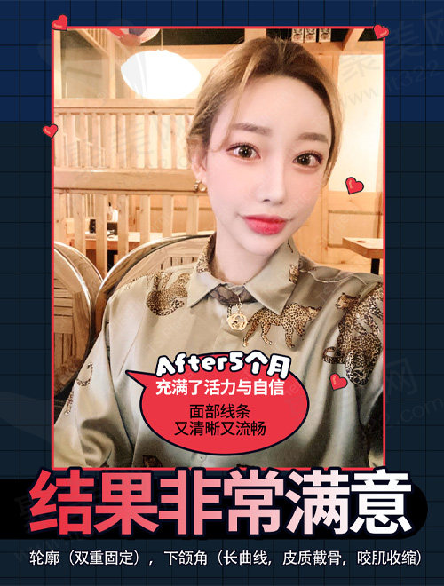 术后五个月