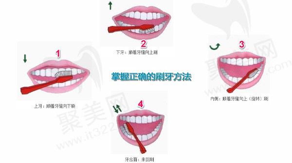 正确刷牙