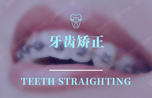 牙齿矫正