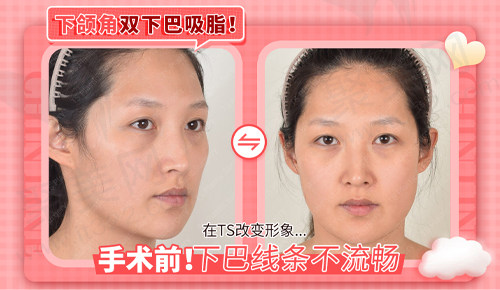 顾客在术前的问题