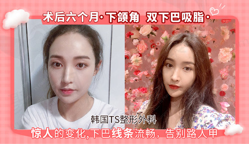 手术过后六个月