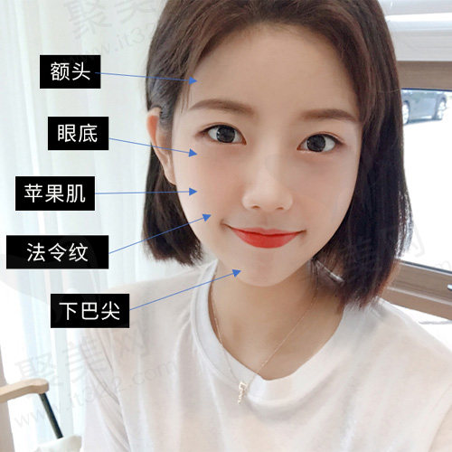 五个需要注意的位置