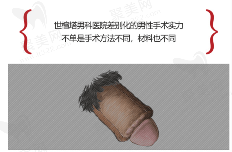 韩国世檀塔男科医院增粗增大