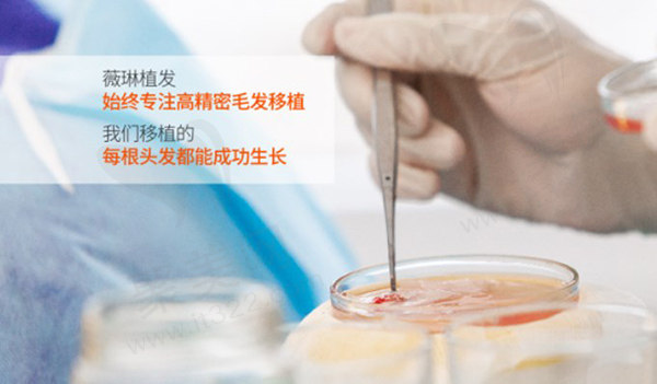 FUE精细植发技术