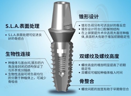 韩国登腾种植牙的优点