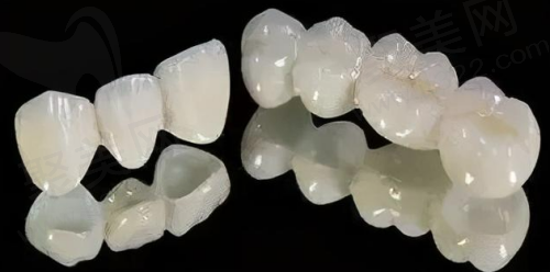 氧化锆材质的全瓷牙更加贵一些